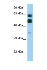 C16orf70 antibody LS-C146167 Western blot of Placenta lysate. Antibody concentration 1 ug/ml.