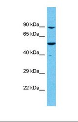Western blot of Human Uterus Tumor. MEIOB antibody dilution 1.0 ug/ml.