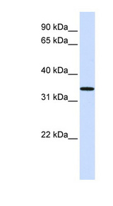 C16orf78 antibody LS-C102451 Western blot of Fetal Lung lysate.