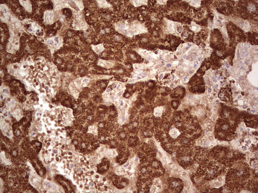 IHC of paraffin-embedded Human liver tissue using anti-ABAT mouse monoclonal antibody. (Heat-induced epitope retrieval by 1 mM EDTA in 10mM Tris, pH8.5, 120°C for 3min).