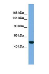 Western blot of Human HT1080. EFCAB13 antibody dilution 1.0 ug/ml.