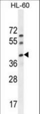 C17orf59 Antibody western blot of HL-60 cell line lysates (35 ug/lane). The C17orf59 antibody detected the C17orf59 protein (arrow).