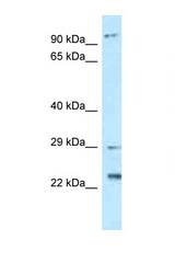 C17orf70 antibody LS-C145838 Western blot of Placenta lysate. Antibody concentration 1 ug/ml.