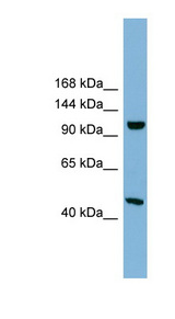 C17orf71 antibody LS-C111978 Western blot of 721_B cell lysate.