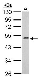 Sample (30 ug of whole cell lysate). A: Hep G2 . 10% SDS PAGE. C17orf75 antibody diluted at 1:1000.