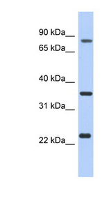 C17orf82 antibody LS-C111759 Western blot of LN18 cell lysate.