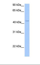 Jurkat cell lysate. Antibody concentration: 1.0 ug/ml. Gel concentration: 12%.