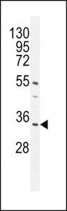 CR025 Antibody western blot of mouse heart tissue lysates (35 ug/lane). The CR025 antibody detected the CR025 protein (arrow).