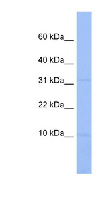 C18orf32 antibody LS-C111858 Western blot of Jurkat lysate.