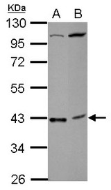 Sample (30 ug of whole cell lysate) A: NT2D1 B: SK-N-SH 10% SDS PAGE C18orf54 antibody diluted at 1:1000