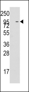 Western blot of anti-MIC1 antibody pre-incubated with and without blocking peptide in K562 cell line lysate. MIC1(arrow) was detected using the purified antibody.