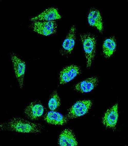 Confocal immunofluorescent of MIC1 Antibody with MDA-MBA231 cell followed by Alexa Fluor 488-conjugated goat anti-rabbit lgG (green). DAPI was used to stain the cell nuclear (blue).