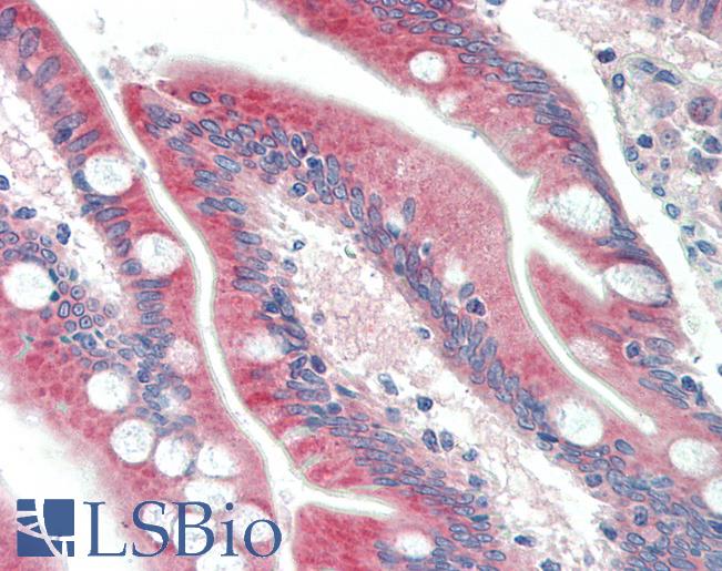 Anti-C18orf8 antibody IHC staining of human small intestine. Immunohistochemistry of formalin-fixed, paraffin-embedded tissue after heat-induced antigen retrieval. Antibody LS-B10290 concentration 5 ug/ml.