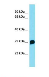 Western blot of Mouse Kidney. R3hdm4 antibody dilution 1.0 ug/ml.