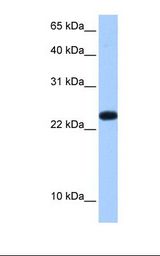 Placenta cell lysate. Antibody concentration: 0.5 ug/ml. Gel concentration: 15%.