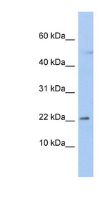 C19orf25 antibody LS-C109916 Western blot of OVCAR-3 cell lysate.