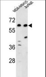 Western blot of C19orf26 Antibody in MDA-MB435, Jurkat cell line lysates (35 ug/lane). C19orf26 (arrow) was detected using the purified antibody.