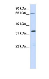 Fetal muscle lysate. Antibody concentration: 1.0 ug/ml. Gel concentration: 12%.