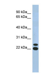C19orf54 antibody LS-C111730 Western blot of Fetal Muscle lysate.