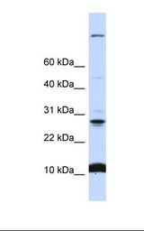 721_B cell lysate. Antibody concentration: 1.0 ug/ml. Gel concentration: 10-20%.