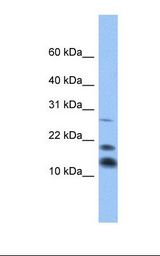 Fetal heart lysate. Antibody concentration: 1.0 ug/ml. Gel concentration: 10-20%.