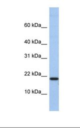 Hela cell lysate. Antibody concentration: 1.0 ug/ml. Gel concentration: 10-20%.