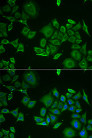 Immunofluorescence analysis of HeLa cell using C1D antibody. Blue: DAPI for nuclear staining.