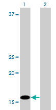 Western blot of C1D expression in transfected 293T cell line by C1D monoclonal antibody (M03), clone 6H2.