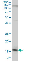 C1D monoclonal antibody (M03), clone 6H2 Western blot of C1D expression in HeLa.