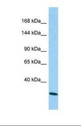 Western blot of Human A549. CAPRIN2 antibody dilution 1.0 ug/ml.