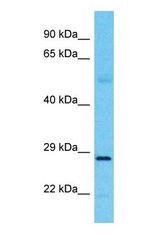 Western blot of C1QL3 Antibody with human A549 Whole Cell lysate.