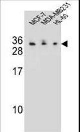 C1QL4 Antibody western blot of MCF-7,MDA-MB231,HL-60 cell line lysates (35 ug/lane). The C1QL4 antibody detected the C1QL4 protein (arrow).