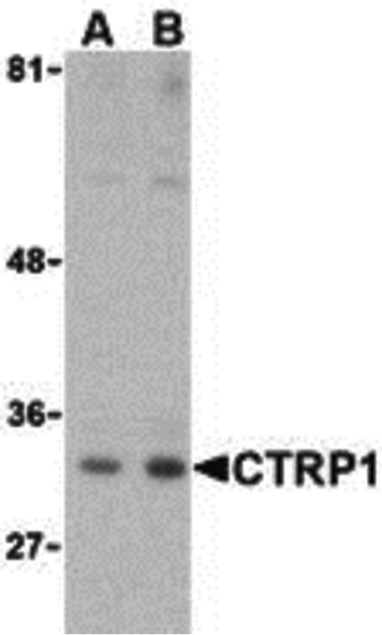 Western blot of CTRP1 in MDA-MD-361 cell lysate with CTRP1 (IN) antibody at (A) 1 and (B) 2 ug/ml.