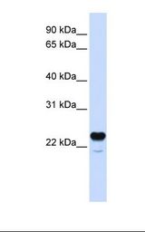 Fetal brain lysate. Antibody concentration: 1.0 ug/ml. Gel concentration: 12%.