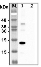 Western blot analysis of recombinant human CTRPs using anti-CTRP1 (human), pAb at 1:4,000 dilution.1: Recombinant human CTRP1 protein (His-tagged).2: Unrelated recombinant protein (His-tagged).