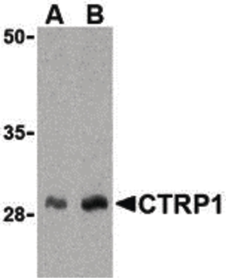 Western blot of CTRP1 in human kidney cell lysate with CTRP1 antibody at (A) 1 and (B) 2 ug/ml.