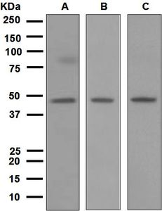 Western blot analysis on (A) Caco-2, (B) HepG2, and (C) Jurkat cell lysates using anti-CTRP2 antibody.