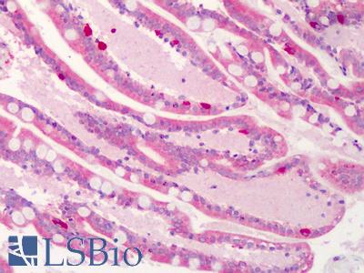 Anti-C1QTNF4 / CTRP4 antibody IHC of human small intestine. Immunohistochemistry of formalin-fixed, paraffin-embedded tissue after heat-induced antigen retrieval. Antibody LS-B1342 concentration 5 ug/ml.