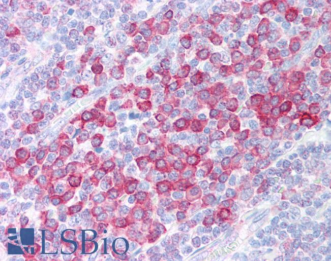 Anti-C1QTNF4 / CTRP4 antibody IHC of human tonsil. Immunohistochemistry of formalin-fixed, paraffin-embedded tissue after heat-induced antigen retrieval. Antibody LS-B1342 concentration 5 ug/ml.