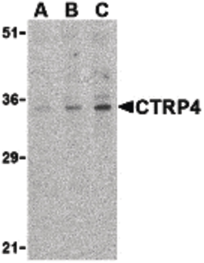 Western blot of CTRP4 in rat brain cell lysate with CTRP4 antibody at (A) 1, (B) 2, and (C) 4 ug/ml.