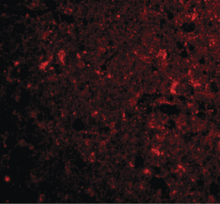 Immunofluorescence of CTRP4 in human brain tissue with CTRP4 antibody at 20 ug/ml.