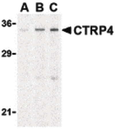 Western blot of CTRP4 in rat brain cell lysate with CTRP4 antibody at (A) 1, (B) 2, and (C) 4 ug/ml.