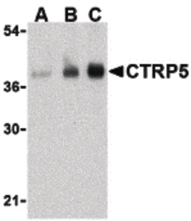 Western blot of CTRP5 in human brain cell lysate with CTRP5 antibody at (A) 1, (B) 2, and (C) 4 ug/ml.