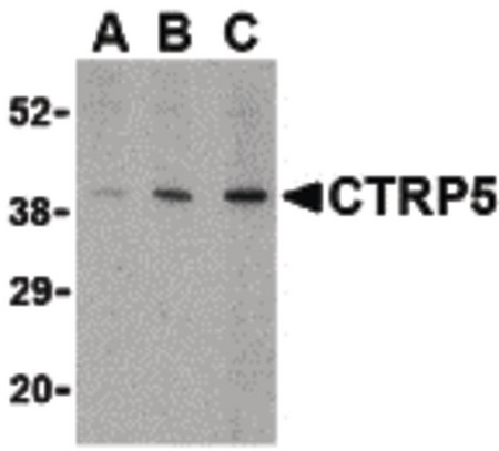Western blot of CTRP5 in Caco-2 cell lysate with CTRP5 antibody at (A) 1, (B) 2, and (C) 4 ug/ml.