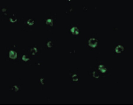 Immunofluorescence of CTRP6 in HeLa cells with CTRP6 antibody at 20 ug/ml.