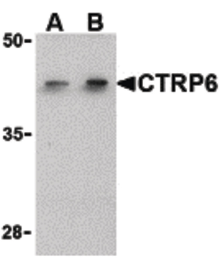 Western blot of CTRP6 in HeLa cell lysate with CTRP6 antibody at (A) 1 and (B) 2 ug/ml.