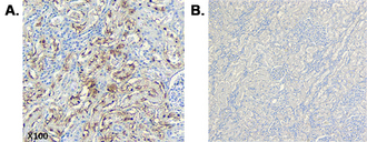 Immunohistochemical staining of CTRP6 using anti-CTRP6 (human), mAb (256-E) in human tissue. Method: A. Paraffin-embedded human kidney tissue, showing stained cell cytoplasm using anti-CTRP6 (human), mAb (256-E) at dilution 1:200 (under X100 lens, Brown color). B. Human kidney stained with isotype control IgG1kappa (Negative control, under X100 lens).