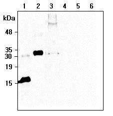Western blot analysis of recombinant human CTRP6 using anti-CTRP6 (human), mAb (256-E) at 1:500 dilution:. 1. Recombinant human CTRP6 (globular domain-less) protein (His-tagged). 2. Recombinant human CTRP6 (full-length) Protein (FLAG). 3. hCTRP6-FLAG (full-length) transfected HEK293 cell lysates. 4. Empty vector transfected HEK293 cell lysates. 5. Recombinant human CTRP6 (globular domain) protein (His-tagged). 6. An unrelated protein (His-tagged).
