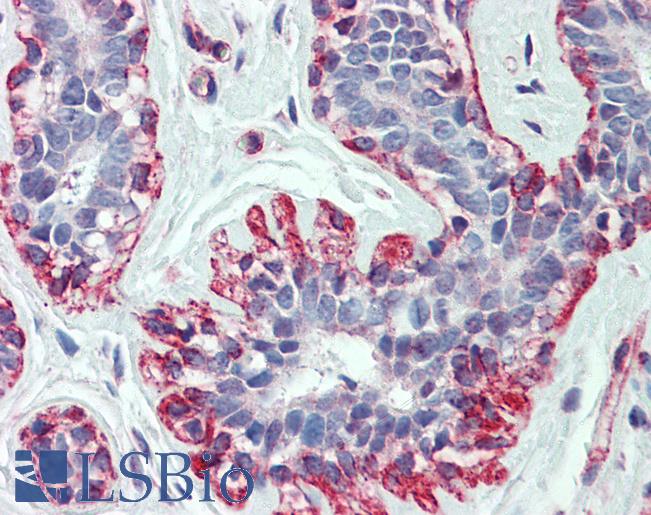 Anti-Beta Actin antibody IHC of human breast. Immunohistochemistry of formalin-fixed, paraffin-embedded tissue after heat-induced antigen retrieval. Antibody LS-B5651 concentration 5 ug/ml.