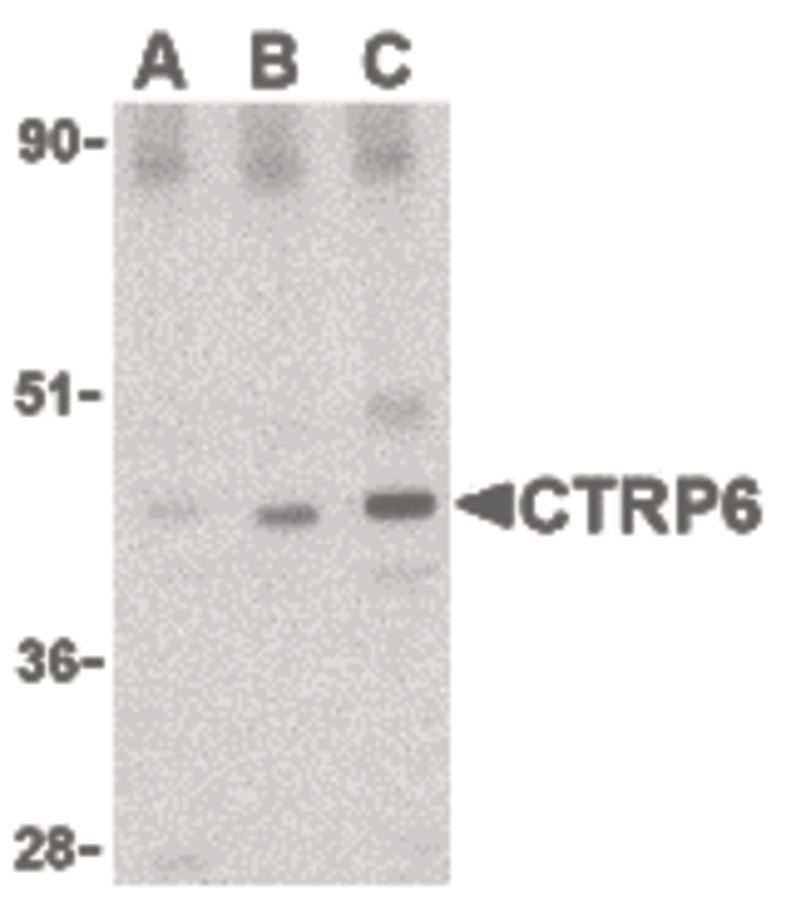Western blot of CTRP6 in mouse brain cell lysate with CTRP6 antibody at (A) 0.5, (B) 1 and (C) 2 ug/ml.